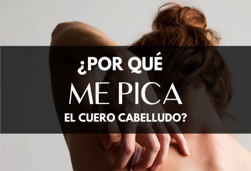 ¿Por qué me pica el cuero cabelludo?