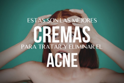 Mejores cremas para tratar el acné: una rutina que no falla