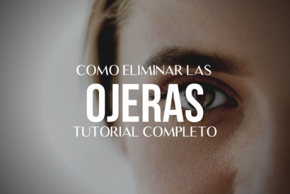 Cómo quitar las ojeras