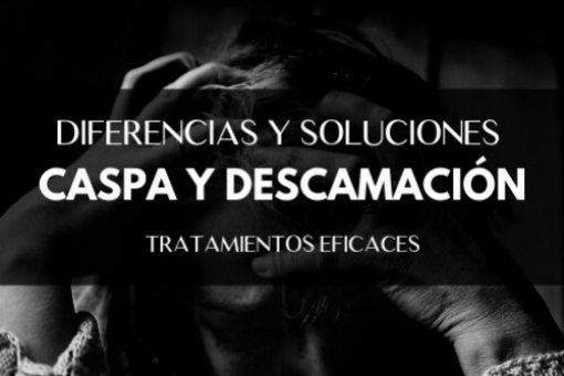 ¿Caspa o descamación? Diferencias y Soluciones